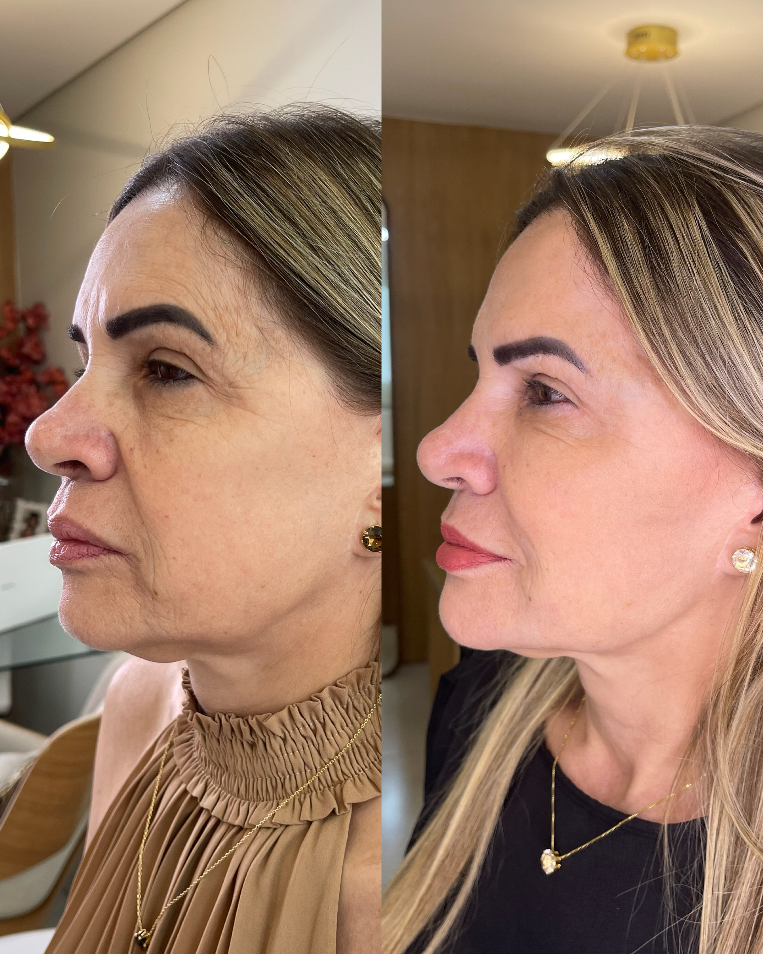 Antes e depois — Método Manzini · Caso 01