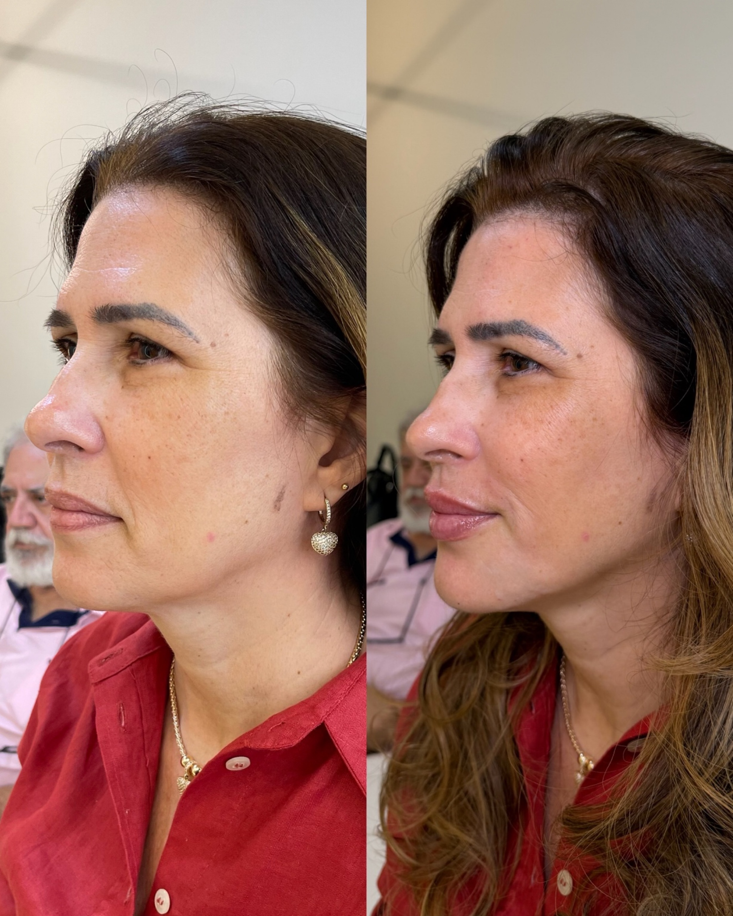Antes e depois — Método Manzini · Caso 02