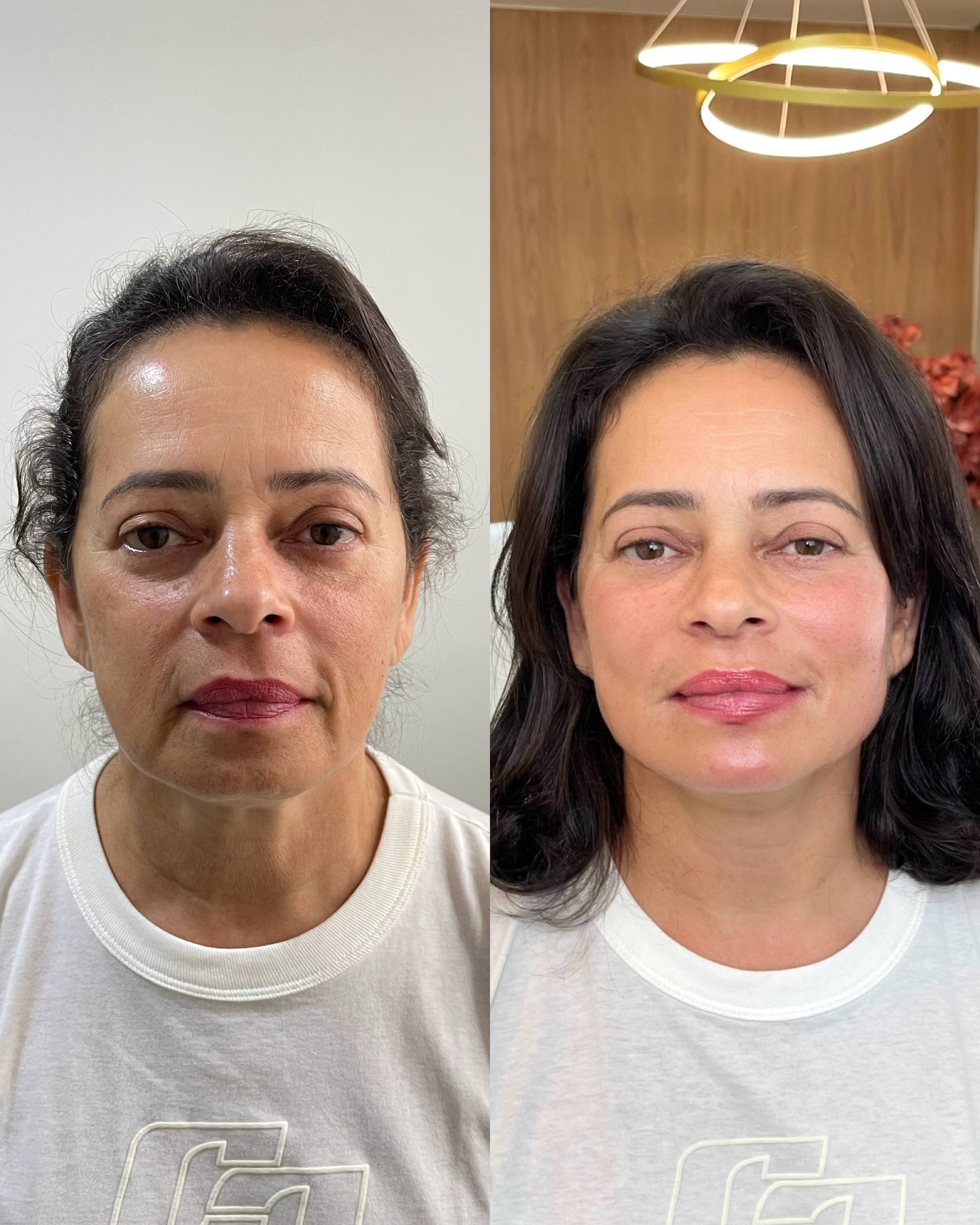 Antes e depois — Método Manzini · Caso 04